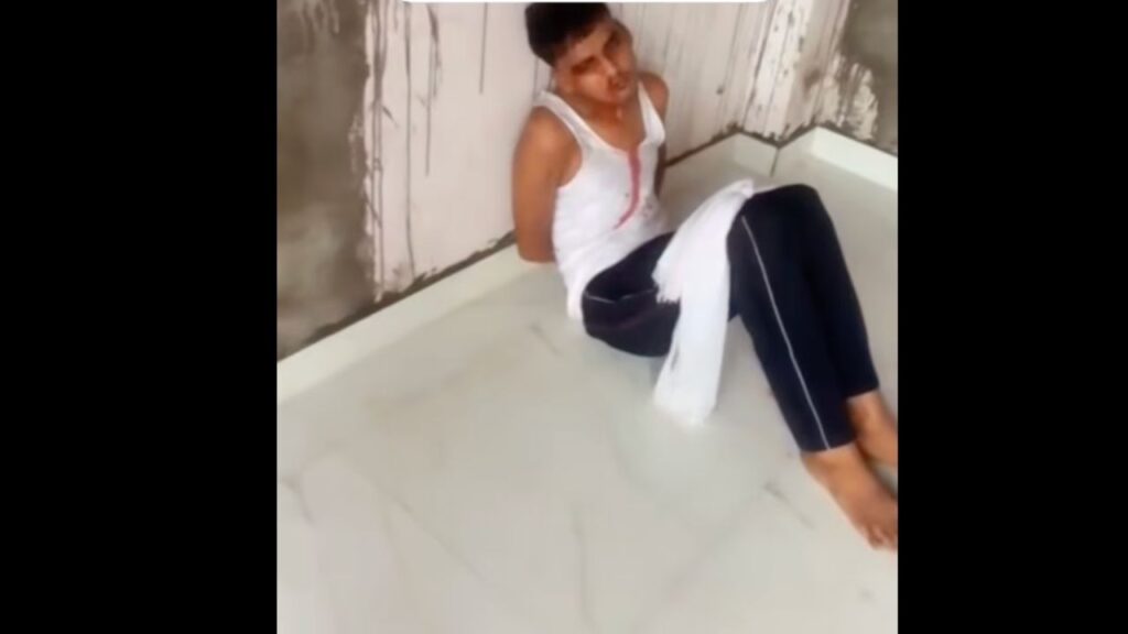 नैनीताल के बिंदुखत्ता में महिला पर चोर का हमला