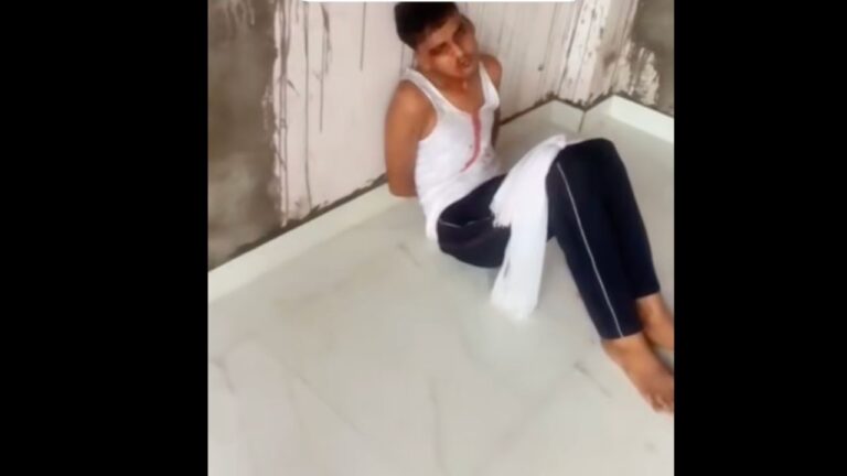 नैनीताल के बिंदुखत्ता में महिला पर चोर का हमला